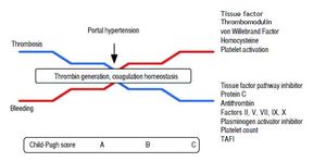 Coagulation abnormalities according to cirrhosis progression, reflected by Child-Pugh Score. As cirrhosis progress, levels of tissue factor pathway inhibitor, protein C, antithrombin, factors II, V, VII, IX, X, plasminogen activator inhibitor, platelet count and TAFI decreases, while tissue factor, thrombomodulin, von Willebrabd Factor, homocysteine and platelet activation increases, leading to stable thrombin generation and a fragile balance between thrombosis and bleeding. Aggregated factors, such as portal hypertension may trigger bleeding or thrombotic events. TAFI: Thrombin-activatable fibrinolysis inhibitor.