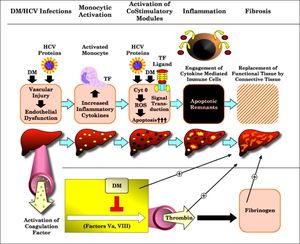 Summary of the overall mechanisms thought to be involved in diabetes mediated liver destruction in chronic hepatitis C patients. Processes are depicted from left to right in chronological sequence.