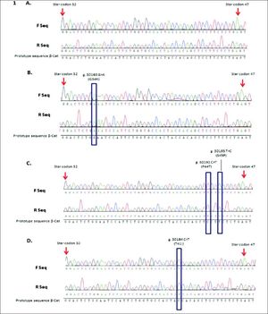 CTNNB1 mutations in HCC cases from Colombia. Representatives sequence chromatogram of CTTNB1 gene (codon 32 to 47). A. Sequence from HCC case wild type. B. Sequence from case #23 HCC with mutation G34K. C. Sequence from case #40 HCC with mutations S45P and P44S. D. Sequence from case #61 HCC with mutation T41I. F Seq: Forward sequence. R Seq: reverse sequence.