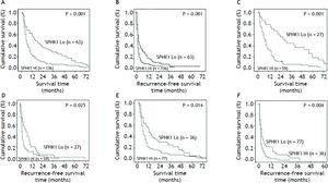 Prognostic significance of SPHK1 assessed by Kaplan-Meier analysis and log-rank tests. Kaplan-Meier analysis of the correlation between SPHK1 expression levels and the overall survival or recurrence of 199 HCC patients (A,B). Over-expression of SPHK1 predicts lower overall survival rates (A) and higher cumulative recurrence rates (B). Kaplan-Meier analysis of the overall survival and recurrence in the stage I PVTT patients (C,D), stage II PVTTpatients (E,F). Over-expression of SPHK1 predicts a lower overall survival rate and a higher cumulative recurrence rate than those whose tumors had decreased expression of SPHK1 in the