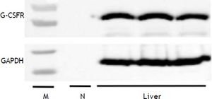 Expression of G-CSF receptor (G-CSFR) in liver tissue. Levels of G-CSFR protein in the liver were detected by western blot. GAPDH was used as a loading control. A no-template negative control is also shown (N). M: marker.