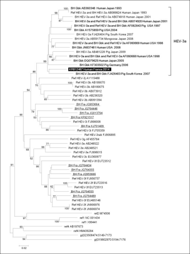 Autochthonous infection with hepatitis E virus related to subtype 3a ...