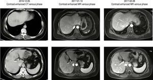 Contrast enhanced CT and MRI images of the liver.