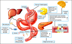 Effects of Roux-en-Y Gastric Bypass surgery on the gut microbiota and its metabolic out comes. RYGB induces various environmental, systemic, and anatomical changes that might directly or indirectly affect the composition of the gut microbiota.