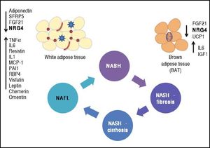 Phenotypic modulation of NAFLD-severity by molecules derived from white (adipokines) and brown (batokines) adipose tissue by inducing or protecting against the progression of the disease. Adipose tissue-derived factors can promote the progression of NAFLD towards severe histological stages (NASH-fibrosis and NASHcirrhosis). This effect can be modulated by the release of adipokines that directly trigger an inflammatory response in the liver tissue or indirectly modulate related phenotypes, such as insulin resistance (up-arrows). Metabolically dysfunctional adipose tissue, which is often infiltrated by macrophages and crown-like histological structures, may also show impaired production of anti-inflammatory adipokines, which may favor NAFLD progression into aggressive phenotypes by preventing its protective effects on the liver tissue (down-arrows). SFRP5: secreted frizzled-related protein 5. UCP1: uncoupling protein 1. FGF21: fibroblast growth factor 21. TNF a: tumor necrosis factor a. IL1 and IL6: interleukin 1 and 6. MCP-1: mono-cyte chemotactic protien-1.