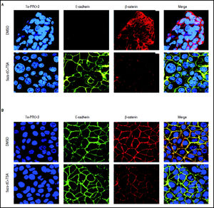 Effects of combined treatments on β-catenin and E-cadherin expression and sub-cellular localization. Representative images of immunofluorescence detection of β-catenin and E-cadherin proteins in HepG2 (A) and HuH7 (B) cell lines. Alexa fluor 555-labeled β-catenin in red, Alexa fluor 488-labeled E-cadherin in green, TO-PRO-3-iodide nuclear staining in blue and the merge between β-catenin and E-cadherin in yellow. The experiments were performed in triplicate.