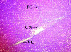 Microscopically photograph of a liver section of Cisplatin treated rats (Group - III); Showing necrosis of the hepatic cells H & E staining (100x) CN: centrilobular necrosis. FD: fatty changes, VC: vacuolization of the cytoplasm.