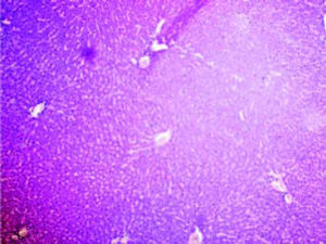 Microscopically photograph of liver section of Cisplatin + Aegle marmelos (4%%) treated rats (Group-V) showing necrosis of the hepatic cells is almost prevented H&E staining.