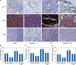 Comparison of the expressions of HIF-1a and VEGF and the MVD-CD34 in hepatic tumor of rats in each group. A. The expressions of HIF-1a, VEGF and CD34 in hepatic tumor of rats in each group detected by immunohistochemica staining. B-D. The statistical graphs for the positive expression of HIF-1a (B), VEGF (C) and CD34 (D) in hepatic tumor of rats in each group. * P < 0.05 compared with the Model group and the Rapamycin + TAE group. # P < 0.05 compared with the Rapamycin group.
