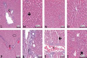 150 μmg/kg Thymol + Indo treated rat liver [C: decreased congestion; small black arrow: decreased sinusoidal dilatation]. N-O. Normal liver histology in 250 μmg/kg Thymol + Indo treated rats. P-T. 500 ßmg/kg Thymol + Indo treated rat liver [The significant histopathological findings in hepatic tissue]. [C: congestion. I: Inflitration; Small black arrow: sinusoidal dilatation. White arrow: kupffer cells. Big black arrow: vacuolar changes in cytoplasm;. Circle symbol. Double white arrow: hemorrhage]. Bars: 100 and 200 μm.