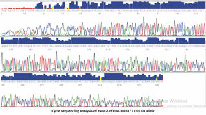 Cycle sequencing analysis of exon 2 of HLA-DRB1*11:01:01 allele