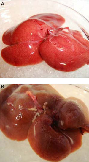 Gross appearance of Liver in rat liver fibrosis model. Representative images of liver samples from Healthy Control rats (A) and LF rats (B).
