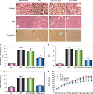 miR-182-5p decreased lipid accumulation in liver tissue and histological damage in HFD mice. (A-D) Representative Oil Red O staining in the NC, HFD, HFD+miR-182-5p NC, and HFD+miR-182-5p groups. (B and C) Livers of the HFD and HFD+miR-182-5p NC groups were filled with large droplets. (D) Livers of the miR-182-5p group were filled with small lipid droplets. (E and H) Representative hematoxylin and eosin staining in the NC, HFD, HFD+miR-182-5p NC, and HFD+miR-182-5p groups. (F and G) Livers of the HFD and HFD+miR-182-5p NC groups exhibited high average adipose-cell cross-sectional areas, (H) The miR-182-5p group exhibited low average adipose-cell cross-sectional areas as compared with areas observed in the (F) HFD and (G) HFD+miR-182-5p NC groups. (I and L) Representative picrosirius red staining to assess the fibrotic index in the NC, HFD, HFD+miR-182-5p NC, and HFD+miR-182-5p groups. The fibrotic index was significantly lower in the HFD+miR-182-5p group as compared with areas observed in the (J) HFD and (K) HFD+miR-182-5p NC groups. Data represent the mean ± standard error of the mean (n = 6, each group). (M) Oil-red O staining revealed lipid droplets in 55% of cells in HFD+miR-182-5p group, which is lower than HFD and HFD+miR-182-5p NC groups. (N) The severity of the NAFLD in the mouse livers was assessed using the NAS. The NAS scores of HFD+miR-182-5p score is 0.7, which is lower than HFD and HFD+miR-182-5p NC groups. (O) The fibrotic index was significantly lower in HFD+miR-182-5p than HFD and HFD+miR-182-5p NC groups. (P)The body weight in the HFD+ miR-182-5p group was also lower than that observed in HFD and HFD+miR-182-5p groups at 16 weeks. *P < 0.05, miR-182-5p group vs. HFD and HFD+miR-182-5p NC groups.