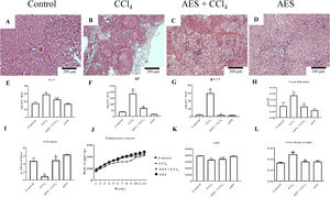 Effect of aqueous extract of stevia (AES) on liver histology and general markers of liver damage in cirrhotic rats. Hematoxylin and eosin staining in the livers of control (A), CCl4-treated (B), AES+CCl4-treated (C), and AES-treated (D) rats. Serum alanine aminotransferase (ALT) (E), alkaline phosphatase (AP) (F) and gamma-glutamyl transpeptidase (γ-GTP) (G) activity and the total bilirubin concentration (I) were determined. The time course of body weight gain during the experiment (J), area under the curve (AUC) (K) and body/liver weight ratios (L) are shown. Each bar represents the mean value of experiments performed in duplicate±SE (n=8). (a) P<0.05 compared with the control group; (b) P<0.05 compared with the CCl4 group.