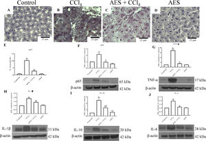 The expression of NF-κB (p65) and proinflammatory cytokines was attenuated by aqueous extract of stevia (AES) in CCl4-induced cirrhosis. Representative images of p65 immunohistochemistry in liver slices from control (A), CCl4-treated (B), AES+CCl4-treated (C), and AES-treated (D) rats. Scale bar=25μm. Percentage of positivity for p65 obtained from immunohistochemistry slices (n=3) (E). The levels of the p65 (F), TNF-α (G), interleukin (IL)-1β (H), IL-10 (I), and Il-6 (J) proteins in samples of liver tissues were examined by western blot analysis (n=3). β-Actin was used as a control. The values are presented as fold increases in the OD values normalized to the values of the control group (control=1). Each bar represents the mean value±SE. (a) P<0.05 compared with the control group; (b) P<0.05 compared with the CCl4 group.