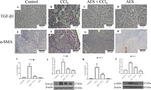 AES prevents HSC activation and preserves normal TGF-β1 in rats with CCl4-induced cirrhosis. Representative images of transforming growth factor-beta (TGF-β) and of alpha-smooth muscle actin (α-SMA) immunohistochemistry in control (A and E), CCl4-treated (B and F), AES+CCl4-treated (C and G), and AES-treated (D and H) rats are shown. The positive area of TGF-β positivity and the percentage of α-SMA-positive cells in slices are shown in histograms I and K, respectively (n=3). The levels of the TGF-β1 (J) and α-SMA (L) proteins in samples of liver tissue were determined by western blot analysis (n=3). β-Actin was used as a control. The values are presented as fold increases in OD values normalized to the values of the control group (control=1). Each bar represents the mean value±SE. (a) P<0.05 compared with the control group; (b) P<0.05 compared with the CCl4 group.