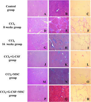 Histopathological analysis of liver tissue of the groups evaluated before treatment and after 8 and 16 weeks. Left side, hematoxylin & eosin (H&E); center, Masson