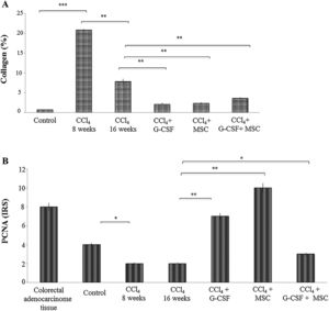 Quantification of collagen in liver tissue and immunohistochemical analysis of the groups evaluated after treatment at 16 weeks. (A) Quantification of collagen percentage stained with sirius red. (B) Immunohistochemistry proliferating cell nuclear antigen (PCNA) in liver tissue: evaluation of staining intensities. Mean±SD (n=3). Significant differences in both analysis. *p<0.05, **p<0.001.