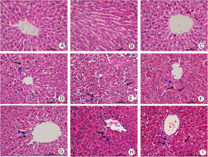 Mild hypothermia improved liver conditions of rats with ALF hepatic tissues in each group were harvested at 4, 8, and 12h for histopathological examination (hematoxylin–eosin staining, 400× magnification); control group at (A) 4h, (B) 8h, and (C) 12h; normothermia group at (D) 4h, (E) 8h, and (F) 12h; mild hypothermia group at (G) 4h, (H) 8h, and (I) 12h. ALF, acute liver failure.