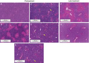 Histological images of liver sections (HE staining) from representative mice from the following groups: (A) VEH (distilled water+canola oil), (B) CCl4 pretreatment (distilled water+CCl4), (C) LD pretreatment (low dose of 0.057mgkg−1 liraglutide+CCl4), (D) HD pretreatment (high dose of 0.118mgkg−1 liraglutide+CCl4), (E) NAC pretreatment (500mgkg−1 N-acetylcysteine+CCl4), (F) CCl4 late treatment (distilled water+CCl4), (G) LD late treatment (low dose of 0.057mgkg−1 liraglutide+CCl4). *, centrilobular necrosis; →, ballooning hepatocytes. Scale bar=100μm.