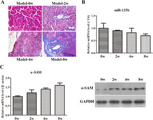 CCl4-induced animal model evaluation. (A) The morphological changes of liver injury and fibrosis were assessed by H&E and Masson's staining, magnification 200×. (B) The miR-125b expression was determined by RT-qPCR in the CCl4-induced animal model. (C) The mRNA and protein levels of α-SMA were examined by RT-qPCR and WB, respectively.