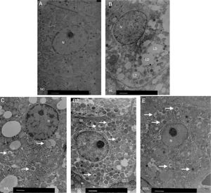 Ultrastructure of hepatocytes observed by electron microscopy. A. NC group, B. HF group, C. 50L group: low dose liraglutide intervention group (50μg/kg), D. 100L group: middle dose liraglutide intervention group (100μg/kg), E. 200L group: high-dose liraglutide intervention group (200μg/kg). N, nucleus; LD, lipid droplet; →, autophagy body.
