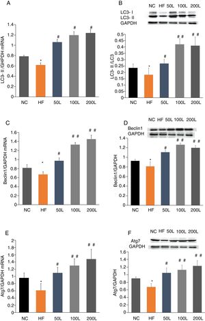 Liraglutide reversed the decrease in autophagy related proteins in HFD-induce NAFLD rats. A and B. LC3II mRNA expression and LC3II/LC3I protein were assessed by real-time RT-PCR and Western blot, respectively. C and D. Beclin1 mRNA and protein expression were detected by real-time RT-PCR and Western blot, respectively. E and F. Atg7 mRNA and protein expression were measured by real-time RT-PCR and Western blot, respectively.