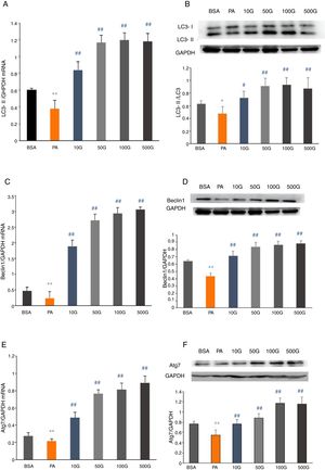 Liraglutide reversed the decrease in autophagy related proteins in HepG2 cells. A and B. LC3II mRNA and protein expression were assessed by real-time RT-PCR and Western blot, respectively. C and D. Beclin1 mRNA and protein expression were detected by real-time RT-PCR and Western blot, respectively. E and F. Atg7 mRNA and protein expression were measured by real-time RT-PCR and Western blot, respectively.