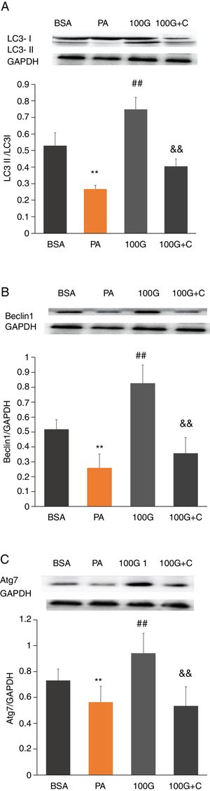 The effect of liraglutide on autophagy in HepG2 cells in the presence of the AMPK pathway inhibitor. A. Expression of LC3II/LC3I detected by Western blot with or without the AMPK pathway inhibitor. B. Expression of Beclin1 detected by Western blot with or without the AMPK pathway inhibitor. C. Expression of Atg7 detected by Western blot with or without the AMPK pathway inhibitor.