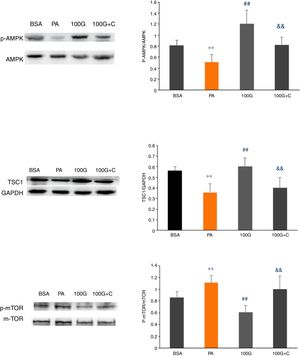 Effects of liraglutide on AMPK pathway-associated proteins in the presence of the AMPK pathway inhibitor. A. Expression of p-AMPK/AMPK detected by Western blot. B. Expression of TSC1 detected by Western blot. C. Expression of p-mTOR/mTOR detected by Western blot.