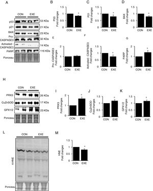 Endurance exercise suppresses apoptosis and improves antioxidative capacity. (A) Representative images of protein expressions. Liver tissue homogenates were immunoblotted for apoptotic proteins p53, p21, BAX, pro-CASPASE3, activated CASPASE3, and DNA repairing enzyme PARP. (B–G) Quantification of proteins listed in (A). (H) Representative images of antioxidative proteins (PRX3, CuZnSOD, and GPX1/2) acquired by immunoblotting. (I–K) Quantification of PRX3, CuZnSOD, and GPX1/3, respectively. (L) A representative image of lipid peroxidation. Liver tissue homogenates were immunoblotted for 4-hydroxynonenal (HNE), an oxidative stress marker of lipid membrane. (M) Quantification of HNE. Ponceau-stained proteins on the nitrocellulose membrane were used as an internal control to ensure equal loading. Data are presented as a mean±SEM (n=9). * Indicates a statistical difference, compared to CON (p<0.05). Con: sedentary control, EXE: Endurance Exercise, SEM: standard of the mean.