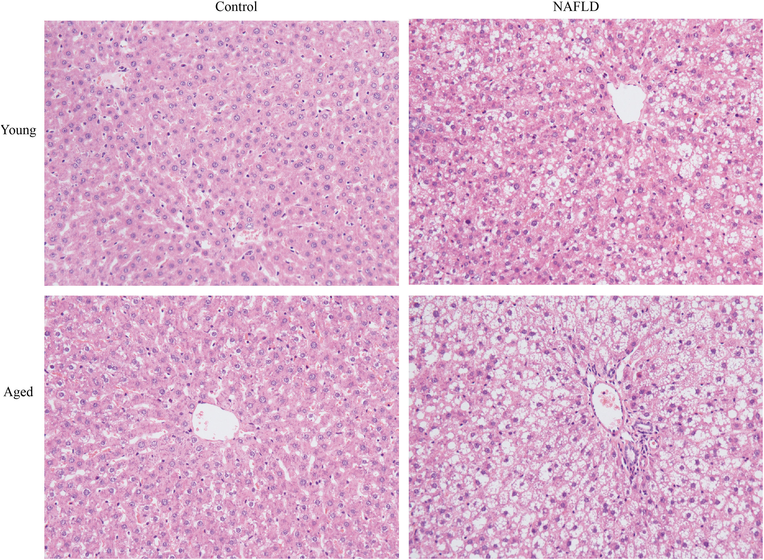 Identification and study of differentially expressed miRNAs in aged ...