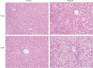 H&E staining of liver tissues (magnification, 200×). Compared with young groups, hepatic cells of the aged groups were significantly larger. Hepatocytes of the NAFLD groups were disarranged, diffuse and enlarged. Fat vacuoles occupied the cytoplasm, compressed cell nuclei to one side, particularly in the aged NAFLD group. Percent macrosteatosis: H&E staining revealed predominantly macrosteatosis in 90% of hepatic cells in aged NAFLD group, which is higher than in young NAFLD group (45%) and aged control group (6%). No macrosteatosis was observed in young control group (0%). H&E, hematoxylin and eosin; NAFLD, non-alcoholic fatty liver disease.