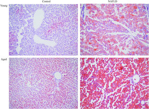 Oil-red-O staining of liver tissues (magnification, 100×). Adipocytes are red and the nucleus is blue. More accumulation of lipid droplets was observed in NAFLD groups, which caused the pushing of the nucleus toward one side, particularly in the aged NAFLD group. NAFLD, non-alcoholic fatty liver disease.