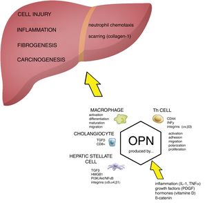 The role of OPN in the pathogenesis of liver damage. Osteopontin (OPN) is involved in regulation of numerous pathological conditions including cell injury, inflammation, fibrogenesis and carcinogenesis. OPN interacts with many signaling pathways including integrins, growth factors and cytokines. OPN acts as a chemoattractant for neutrophils and macrophages. During cell injury and inflammation OPN activates hepatic stellate cells and it has been directly implicated in fibrogenesis (scarring). Akt, protein kinase B; HMGB1, high mobility group box 1 protein; HSC, hepatic stellate cells; IL-1, interleukin 1; OPN, osteopontin; PDGF, platelet-derived growth factor; PI3K, phosphatidylinositol 3-kinase; NFκB, nuclear factor kappa-B; PKC, protein kinase C; TGFβ, transforming growth factor beta; TNFα, tumor necrosis factor alpha.