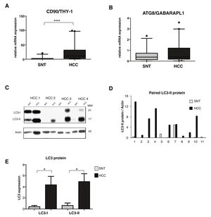 Relevance of autophagy in HCC tissues. A. mRNA expression of CSC marker CD90/THY-1. B. mRNA expression of autophagy marker ATG8/GABARAPL1 C. Representative of LC3 blotting of paired HCC and its corresponding surrounding non-tumoral tissue (SNT) showed the presence of LC3-I (21 kDa) and LC3-II (17 kDa). Actin was used as housekeeping protein. D. Relative LC3-II expression of eleven paired HCC and SNT. Densitometric analysis was performed by normalizing LC3-II signal to actin. E. Mean value of LC3-I and LC3-II protein expression. Target gene was normalized to two reference genes ACTB and 18sRNA. The expression of a normal sample was considered as 1.0. Student's t-test: * p < 0.05, *** p < 0.001