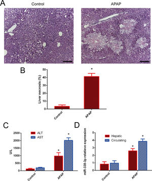 miR-338-3p expression levels in APAP-induced liver injury. (A) Representative images of H&E-stained liver tissue (magnification, ×200. (B) Quantification of the necrotic area (%) by evaluating six independent fields for each section. (C) The levels of serum AST and ALT from APAP and PBS-treated mice. (D) The liver and serum expression levels of miR-338-3p in mice in the APAP- and PBS-treated groups. Histogram shown as means±standard deviation of values from three independent experiments. *Significant compared with APAP group, P<0.05.