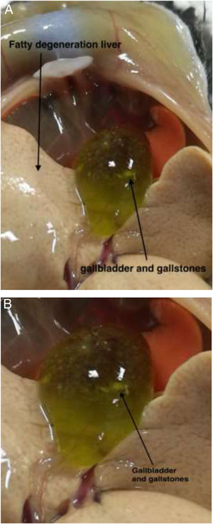 Liver and gallbladder after 8 weeks of lithogenic diet (LD) feeding. (A) Gallbladder and liver. (B) Gallbladder and gallstone.