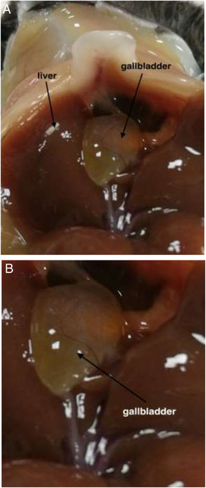 Liver and gallbladder after 8 weeks of lithogenic diet with TUDCA feeding. (A) Gallbladder and liver. (B) Gallbladder.