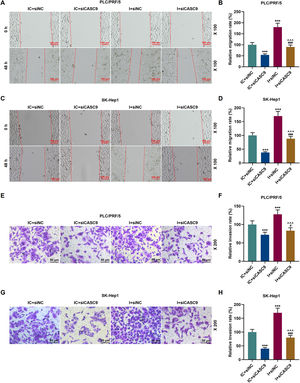 Down-regulated CASC9 inhibited the migration and invasion of HCC cells by negatively regulating miR-424-5p. (A): Wound healing assay was used to detect the effects of CASC9 and miR-424-5p on the migration of PLC/PRF/5 cells. Scale: 100 μm; magnification: ×100. (B): The migration rate of PLC/PRF/5 cells was calculated. n = 3. (C): Wound healing assay was used to detect the effects of CASC9 and miR-424-5p on the migration of SK-Hep1 cells. Scale: 100 μm; magnification: ×100. (D): The migration rate of SK-Hep1 cells was calculated. n = 3. (E): Transwell assay was used to detect the effects of CASC9 and miR-424-5p on the invasion of PLC/PRF/5 cells. Scale: 50 μm; magnification: ×200. (F): The number of invasive PLC/PRF/5 cells was counted. n = 3. (G): Transwell assay was used to detect the effects of CASC9 and miR-424-5p on the invasion of SK-Hep1 cells. Scale: 50 μm; magnification: ×200. (H):The number of invasive SK-Hep1 cells was counted. n = 3. * vs. IC + siNC; ^ vs. IC + siCASC9; # vs. I + siNC. *** p < 0.001; ^^^ p < 0.001; ### p < 0.001. Abbreviation: HCC, Hepatocellular carcinoma; siNC, small interfering RNA of negative control; IC, inhibitor control; I, miR-424-5p inhibitor.