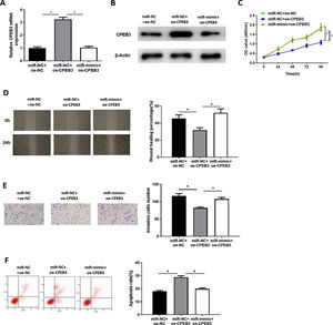 miR-20b-5p promotes HCC cell proliferation, migration and invasion, and inhibits cell apoptosis by targeting CPEB3. (A-B) CPEB3 mRNA and protein expression in the miR-NC + oe-NC, miR-NC + oe-CPEB3 and miR-mimic + oe-CPEB3 groups. The proliferative ability, migratory ability and invasive ability of Huh-7 cells were detected via (C) CCK-8 assay, (D) wound healing assay (40×) and (E) Transwell invasion assay (100×); (F) Flow cytometry was conducted to evaluate the apoptotic rate of Huh-7 cells. *p < 0.05.