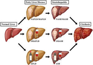 Interaction of various factors in the etiology of fatty liver diseases and steatohepatitis.