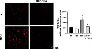 HGF treatment decreases reactive oxygen species (ROS) induced by transforming growth factor beta (TGF-β). Primary mouse hepatocytes were treated with HGF (50 ng/mL) for 12 h after that cells were treated with TGF-β (10 ng/mL) and ROS were determined using dihydroethidium (DHE, 50 μM) fluorescence (red), for 15 min, in the dark. Images are representative of at least three independent experiments. Each bar represents the average ± SEM, * p < 0.05 vs NT; # p < 0.05 vs TGF-β.