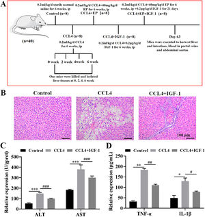IGF-1 attenuates CCL4-induced cirrhosis in the rat. (A) The schematic presents the animal experiment schedules in this study. The rat was executed after receiving the desired treatment, and then liver, cecum tissues, and portal venous blood were collected. Histomorphology changes of the liver (B) were evaluated by H&E staining and photographed under a light microscope. Magnification: 200 ×, scale bars = 100 μm. (C) The levels of AST and ALT portal venous blood were examined using AST activity assay kit and ALT activity assay kit, respectively. (D) Serum levels of TNF-α and IL-1β were examined using commercial ELISA kits. *P<0.05, ⁎⁎P<0.01, ⁎⁎⁎P<0.001, vs. control group, #P<0.05, ##P<0.01, ###P<0.001, vs. CCL4 group.