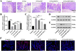 IGF-1 significantly reduced the level of HMGB1 in cecum tissues. All rats were executed on day 63 following IGF-1 injection and cecum tissues were collected. (A) H&E staining was used to observe the histological change of cecum tissues. Scale bars = 100 μm. The mRNA and protein levels of claudin-1 (B, D) and HMGB1 (C, E) in cecum tissues were examined using qRT-PCR and western blotting, respectively. (F) Immunofluorescence analysis of HMGB1 distribution in cecum tissues. Magnification: 400 ×, scale bars = 50 μm. ⁎⁎⁎P<0.001, vs. control group, #P<0.05, ###P<0.001, vs. CCL4 group, &&P<0.01, &&&P<0.001, vs. CCL4+EP group.