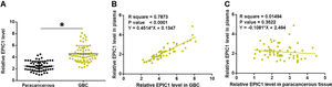EPIC1 was upregulated in GBC and positively correlated with its level in plasma. EPIC1 levels in GBC and paracancerous tissues and in plasma were measured by qPCR. Difference in EPIC1expression levels between GBC and paracancerous tissues was analyzed in paired t test (A). Correlations between EPIC1 levels in GBC (A) and paracancerous (B) tissues and in plasma were analyzed by linear regression. qPCR was performed 3 times and data are presented as the mean values. * p<0.05.