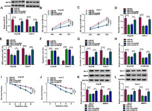 MiR-578 suppresses tumorigenesis and enhances radiosensitivity in HCC cells via IGF1R. (A-L) Hep3B and Huh-7 cells were co-transfected with miR-NC, miR-578, miR-578 + pcDNA, or miR-578 + IGF1R. (A) Detection of IGF1R expression in cells using Western blot. (B-E) Cell proliferation analysis using CCK-8, colony formation, and EDU assays. (F) Cell apoptosis analysis using FCM. (G) Transwell assay for cell invasion. (H) Tube formation ability of HUVECs cultivated in the TCM from transfected cells. (I, J) Colony formation assay for survival fraction in cells exposed to various doses of irradiation (0, 2, 4, 6 or  8 Gy). (K, L) Western blot analysis for the levels of Bcl-2 and MMP9 protein. **P<0.01, ***P<0.001, ****P<0.0001.