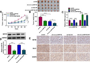 Circ-LARP1B impedes tumor growth and enhances irradiation sensitivity in HCC in vivo. (A) Detection of tumor volume of each group was conducted every 4 days starting 8 days after inoculation. (B) Tumor weight of each group was detected at day 28 and the representative images of xenografts were shown. (C, D) qRT-PCR and Western blot analysis of circ-LARP1B, miR-578 and IGF1R expression levels in tumors isolated from each group. (E) Representative images of IGF1R, Bcl-2 and MMP9 protein staining in tumors of each group. *P < 0.05, ***P<0.001, ****P<0.0001.