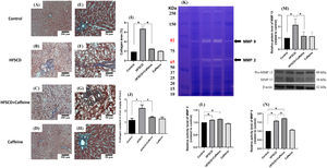 Caffeine prevents fibrosis and profibrogenic mediators and regulates extracellular MMPs in rats fed a high-fat, high-sucrose, high-cholesterol diet (HFSCD). Effect of caffeine as shown by Masson