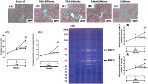 Caffeine abrogates fibrosis and profibrogenic mediators and regulates extracellular MMPs in rats with TAA-induced cirrhosis. Effect of caffeine as shown by Masson